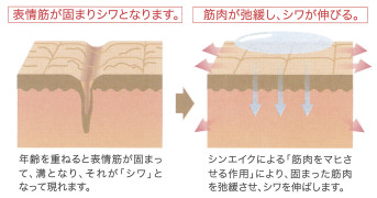 シンエイク シワを伸ばす 弛緩